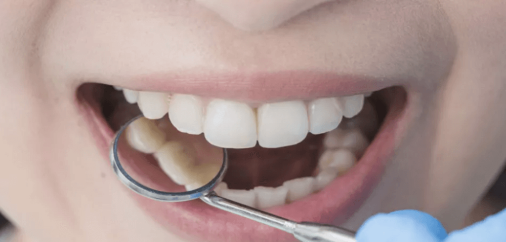 أسرار العناية بالأسنان وتبيضها منزليًا 2026