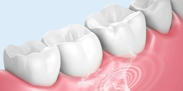 جهاز الخيط المائي أكثر فعالية لتنظيف أسنانك 2026